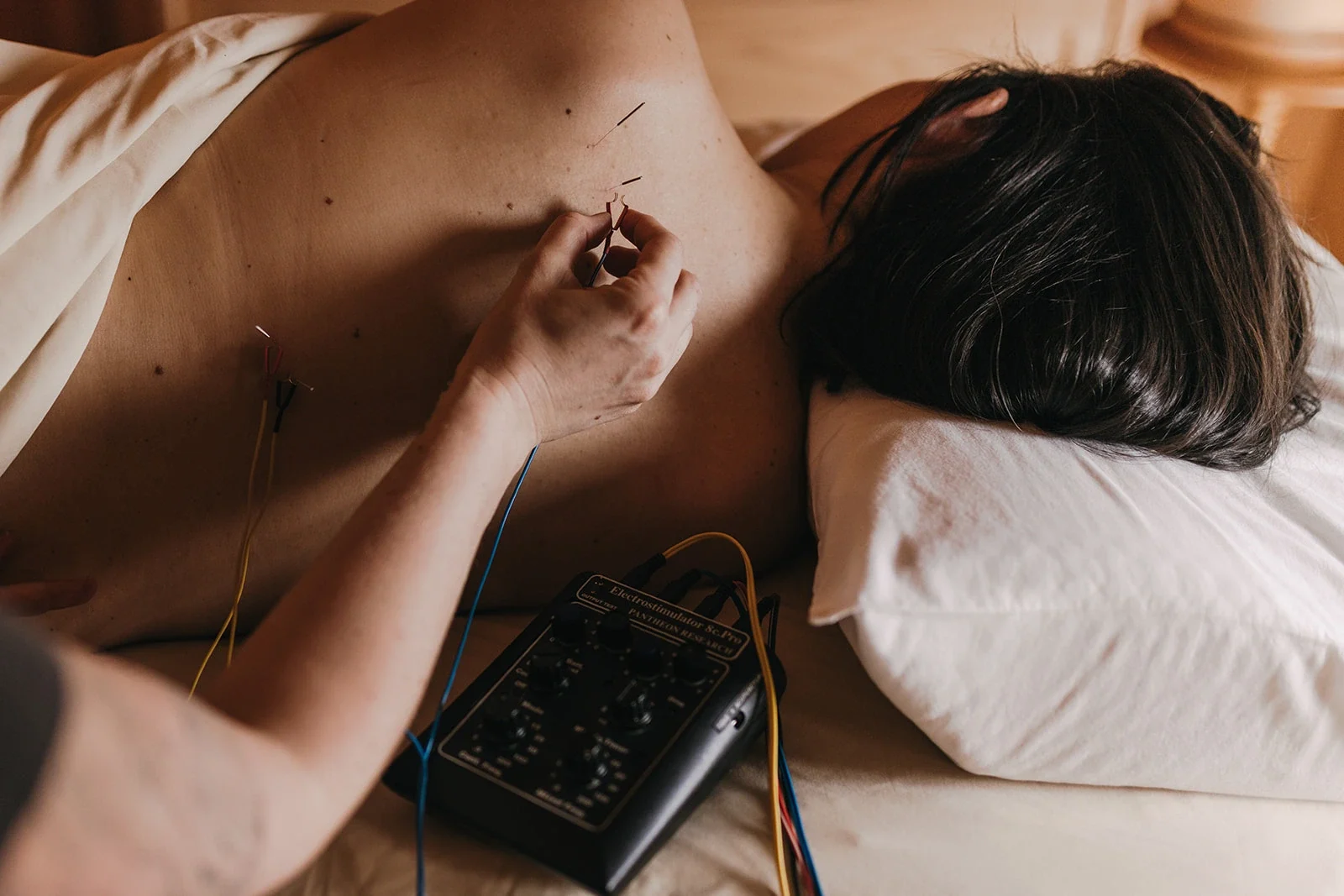 An acupuncturist places needles along a patient's upper back, with an electro-stimulation unit beside the pillow, at Mandala Medicine in Portland
